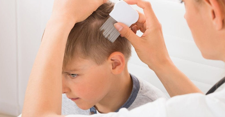 ۴ راه برای جلوگیری از شپش سر در کودکان نوپا