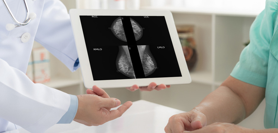 مواردی که قبل از انجام ماموگرافی باید بدانید