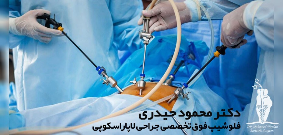 جراحی لاپاراسکوپی جدیدترین متد در انواع جراحی های لاغری