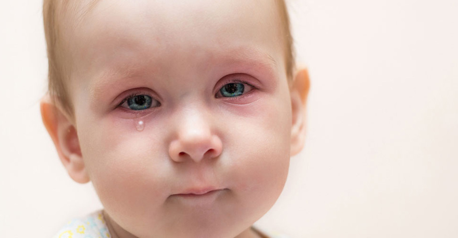کافه کالا | چه چیزی باعث قرمزی دور چشم کودک می‌شود؟ (2021)