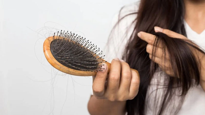 علل ریزش مو در زنان