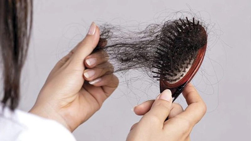 راه‎های جلوگیری از ریزش مو بعد از رژیم