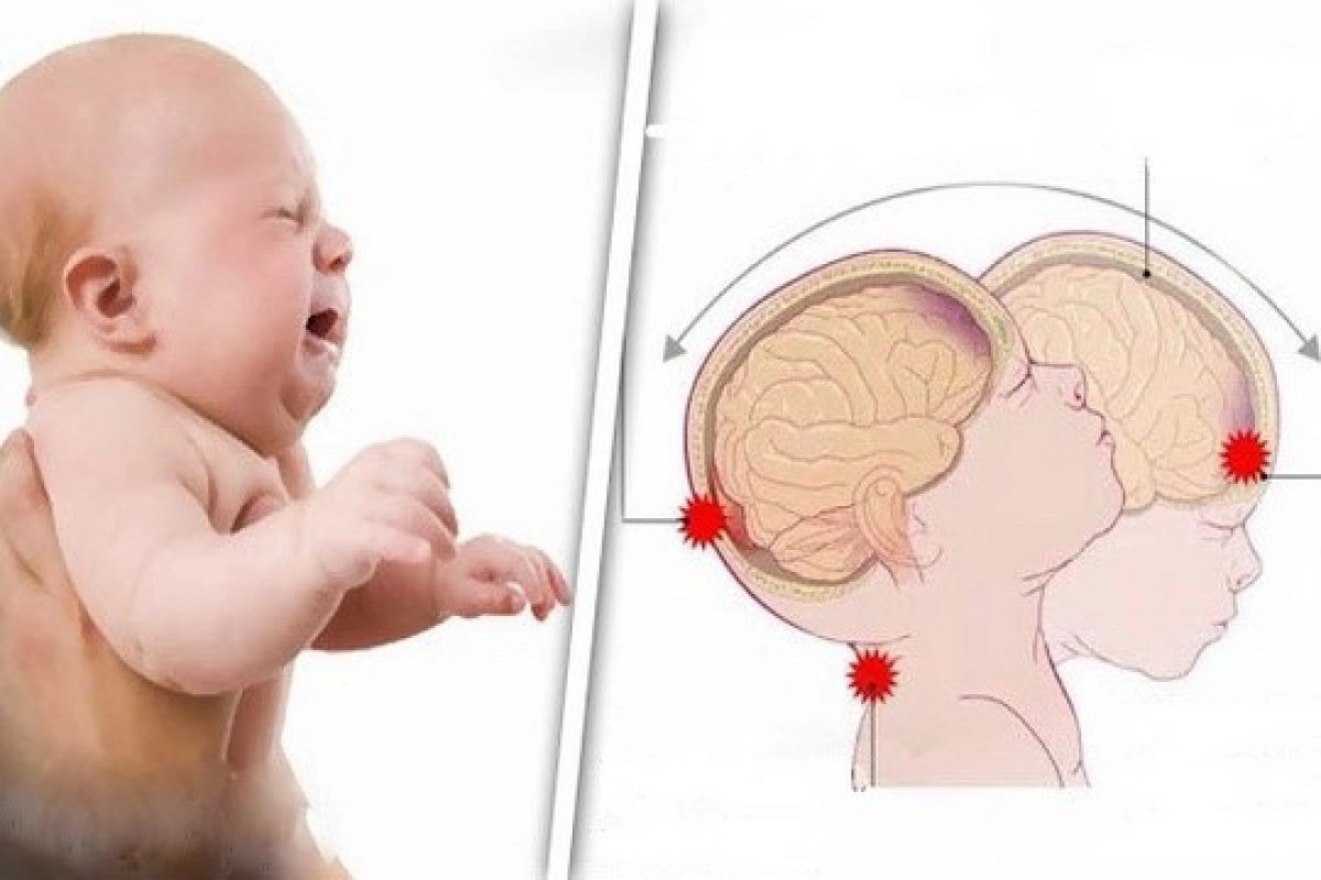 عوارض به هوا پرتاب کردن نوزاد