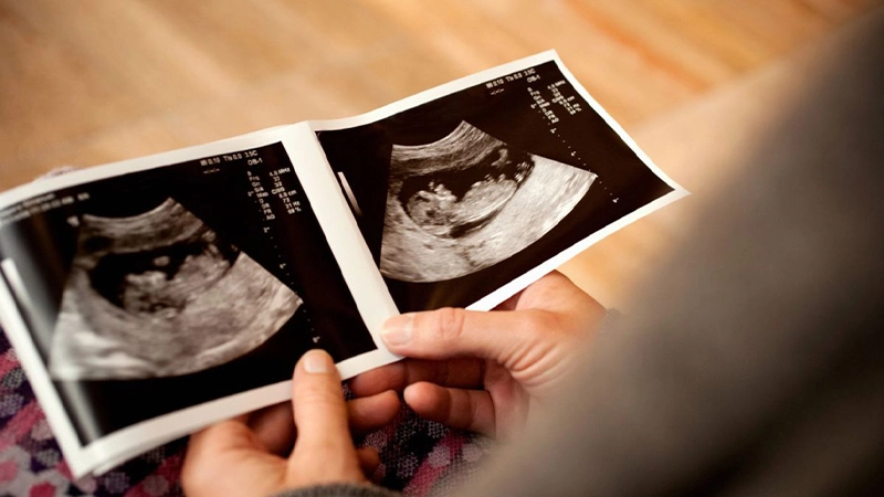 میشه قبل از بارداری تعیین جنسیت کرد؟