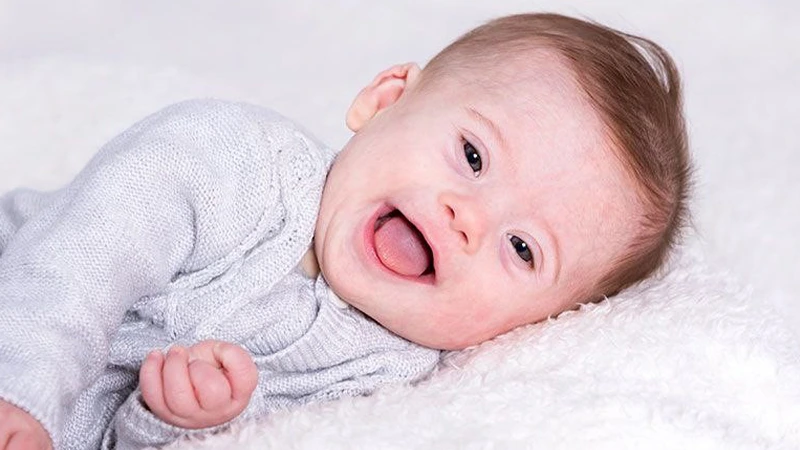 شیوه‌های تشخیص سندروم داون در نوزاد